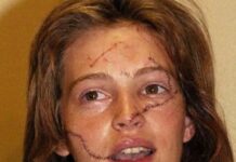 Μια γενναία κοπέλα: Το 24χρονο μοντέλο Μάρλα Χάνσον